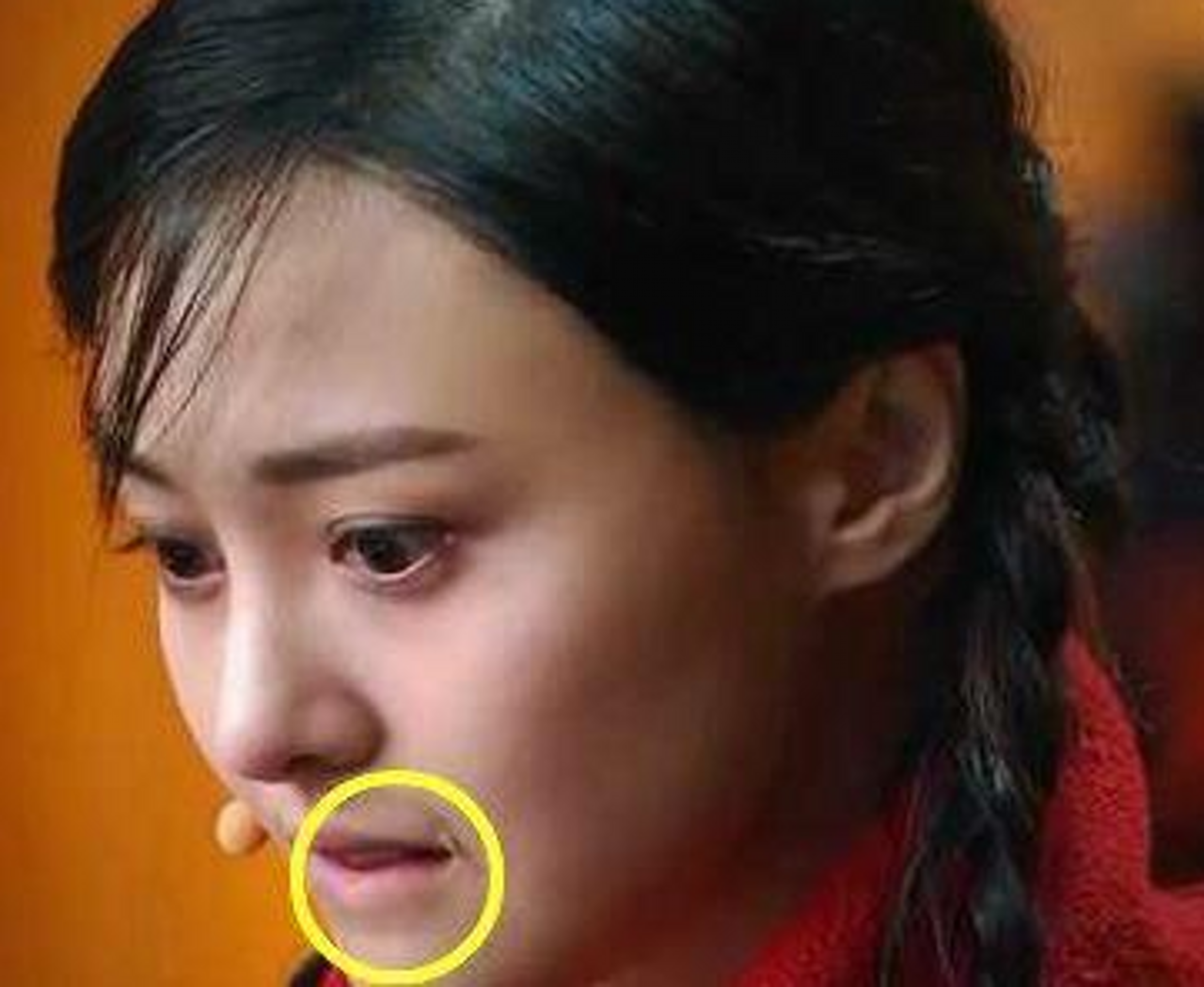 明星脸上的疤痕,独特之美与坚韧力量的象征