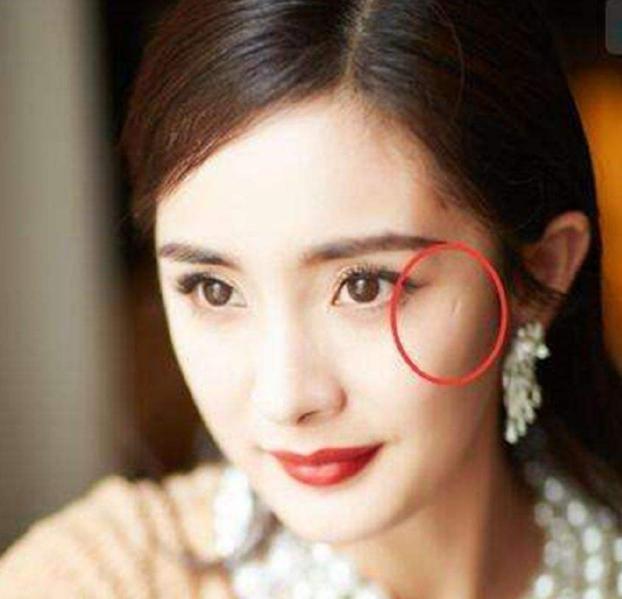 明星脸上的疤痕,独特之美与坚韧力量的象征