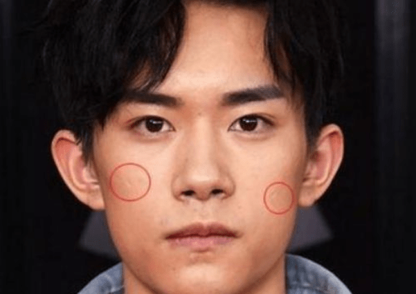 明星脸上的疤痕,独特之美与坚韧力量的象征