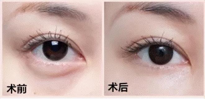 玻璃基覆铜板 第259页